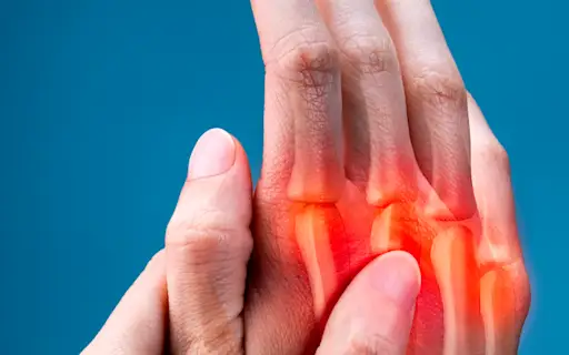 关节辐射疼痛。