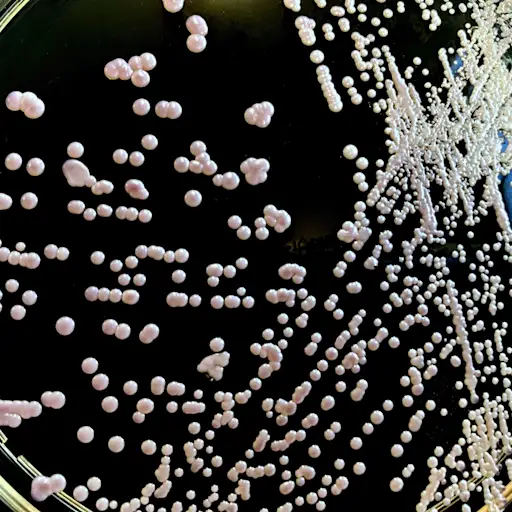 假丝酵母glabrata