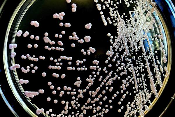 Candida Glabrata.