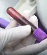 血液测试