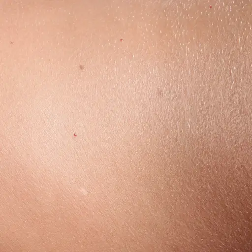 9 Sneaky Warning Signs Of Melanoma You Might Miss 9 Sneaky Warning Signs Of Melanoma You Might Miss