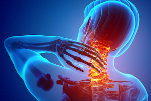 突出颈部痉挛。