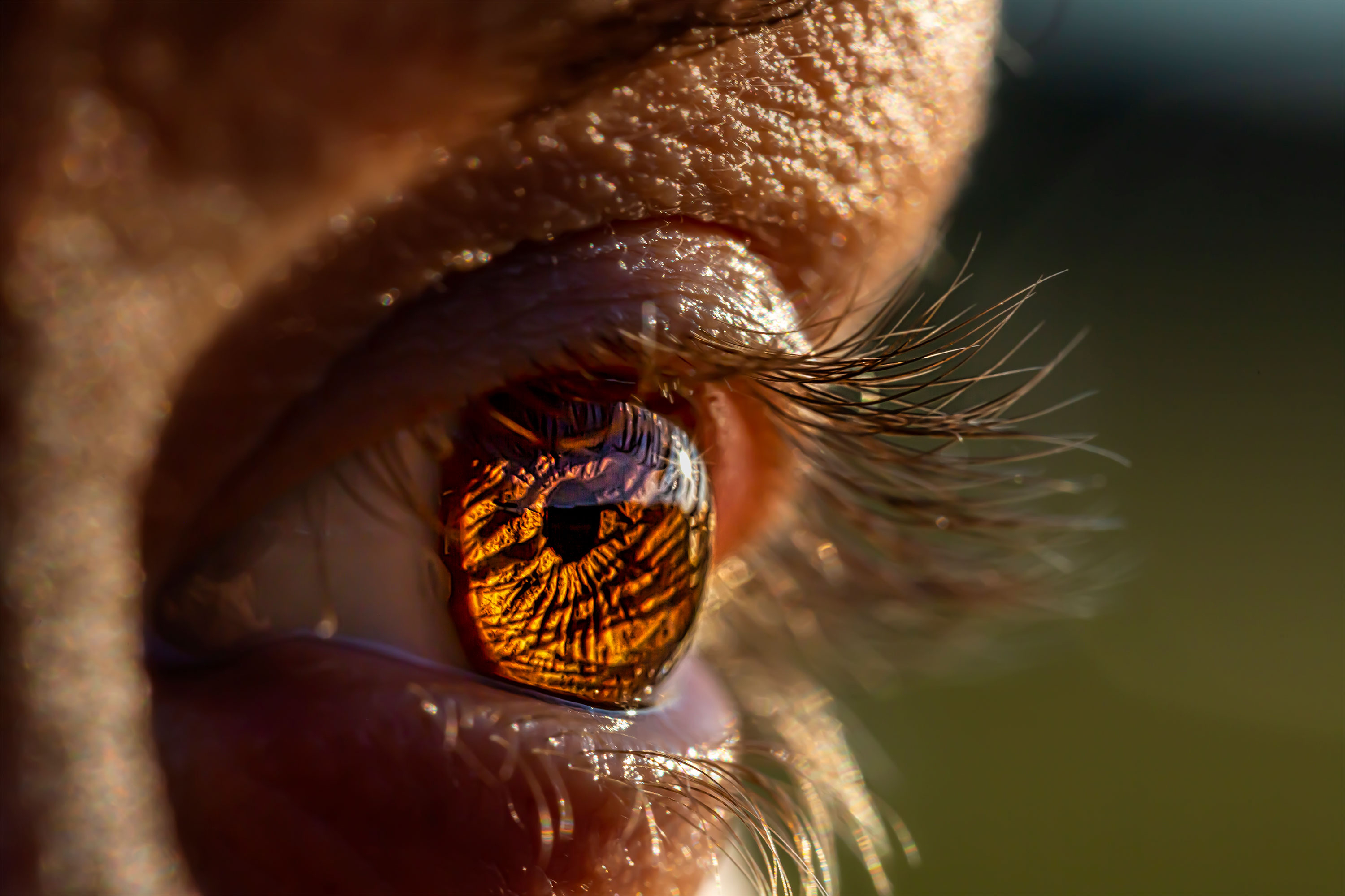 Optic Neuritis and MS What’s the Connection?