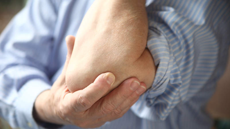 患有严重的类风湿性关节炎的关节疼痛的男人。