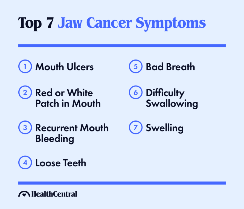 下颌骨癌的症状是口腔溃疡、口腔出现红白斑块、经常性口腔出血、牙齿松动、口臭、吞咽困难和肿胀