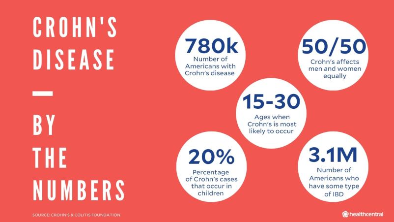 克罗恩病的统计，患有克罗恩病的美国人的数量，女性患者的百分比，最可能发生克罗恩病的年龄，发生在儿童的克罗恩病的百分比，美国IBD患者的数量