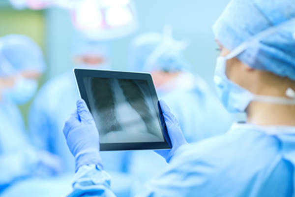 外科医生正在做肺手术。