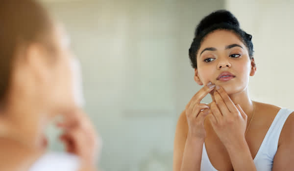 一个女人看着镜子里她下巴周围的粉刺。痤疮是多囊卵巢综合征的症状之一。