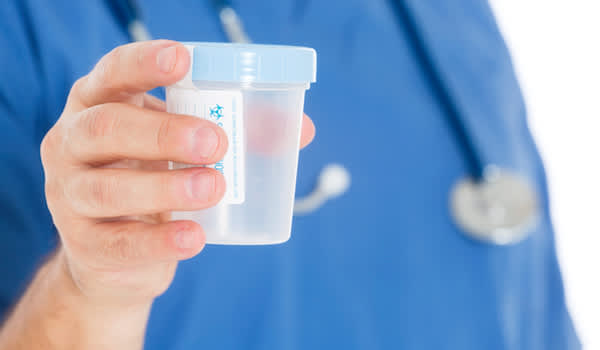 医生移交尿样杯相机。