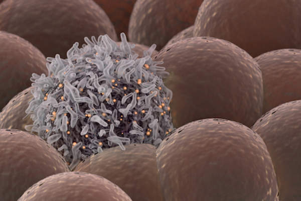 其中包括健康细胞癌细胞。