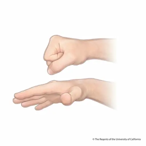 8 Exercises For Hand Arthritis 8 Exercises For Hand Arthritis