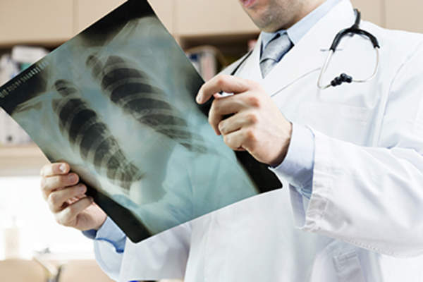 医生正在做肺部x光检查。