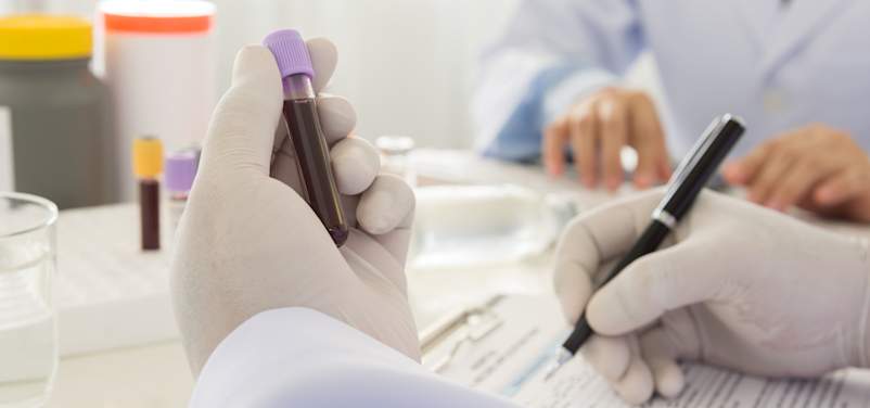 血液测试可预测高血压