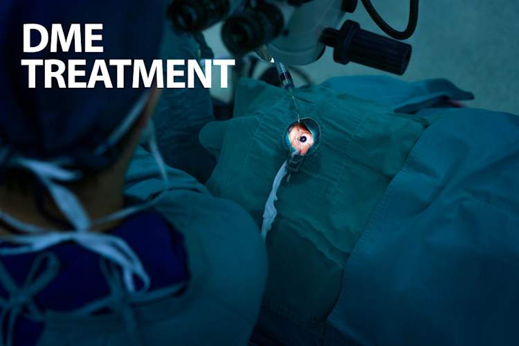 DME治疗