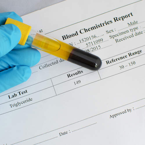 血样和血液检测结果。
