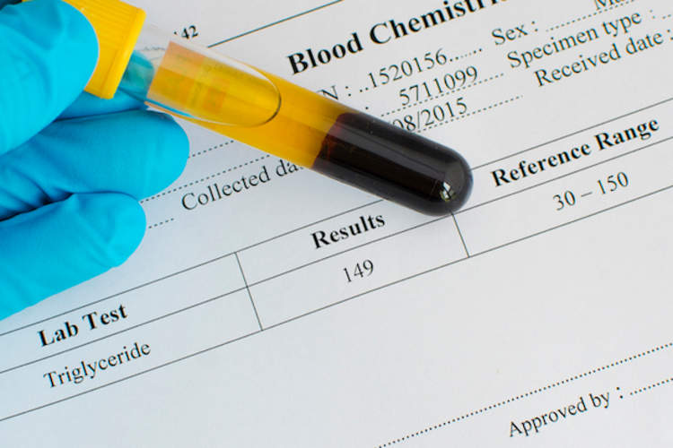 血样和血液检测结果。