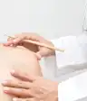 黑色素瘤被圈起来做手术。