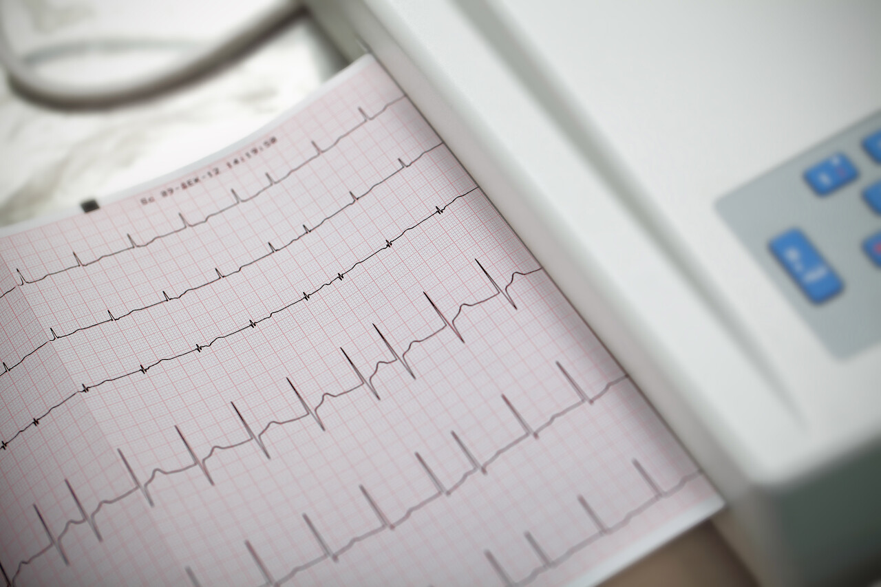 What Is a Dangerous Heart Rate With Afib?