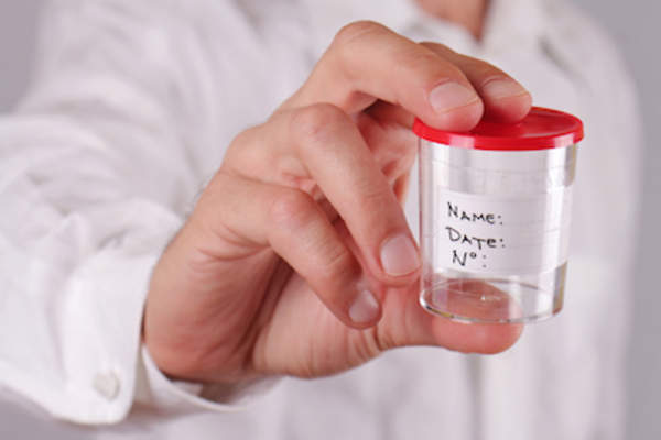 男子持有无菌样品容器进行医学分析。