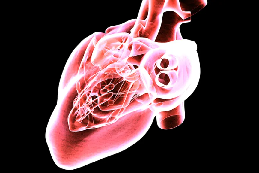 心脏磁共振成像扫描。