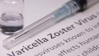 水痘带状疱疹