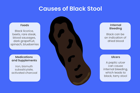 diarrhea after taking glutathione Side Effects: What to Know What Causes Black or Tarry