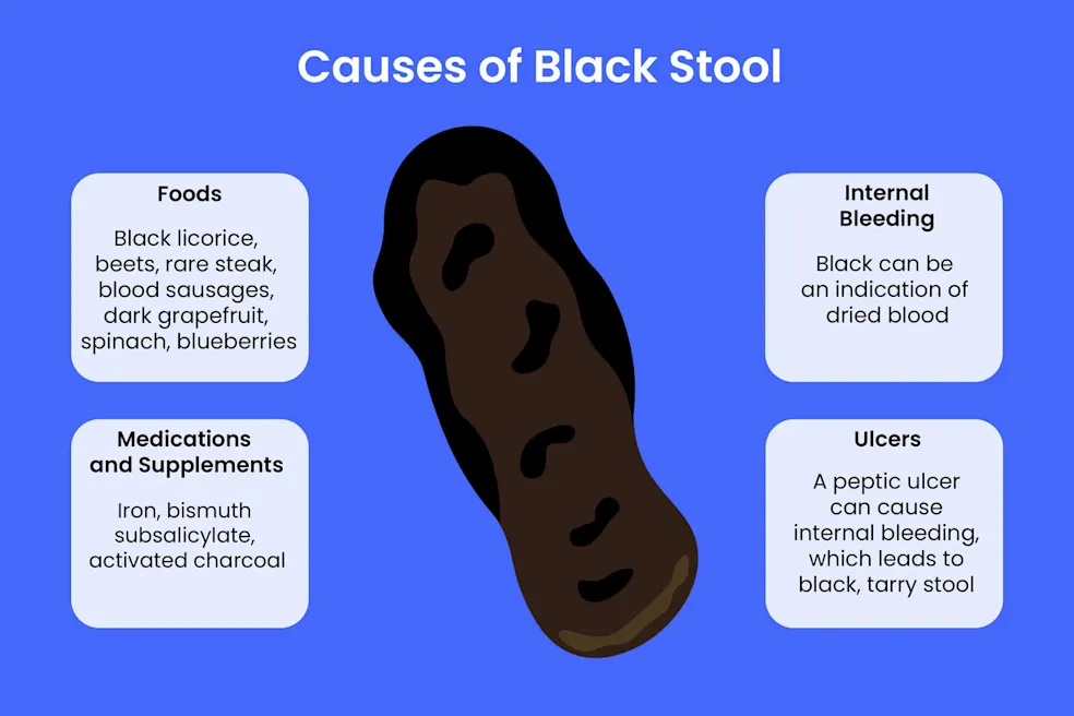 Black Stool Causes