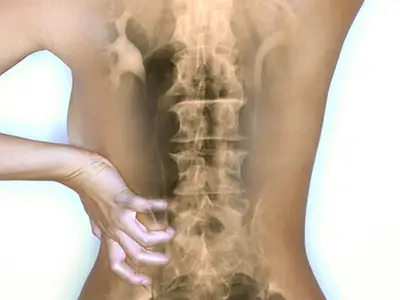 女人的背部疼痛。