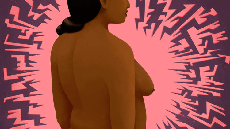 插图宣传-不祥的，妇女转向一边，乳腺癌的概念