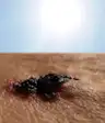 melanoma in the sun
