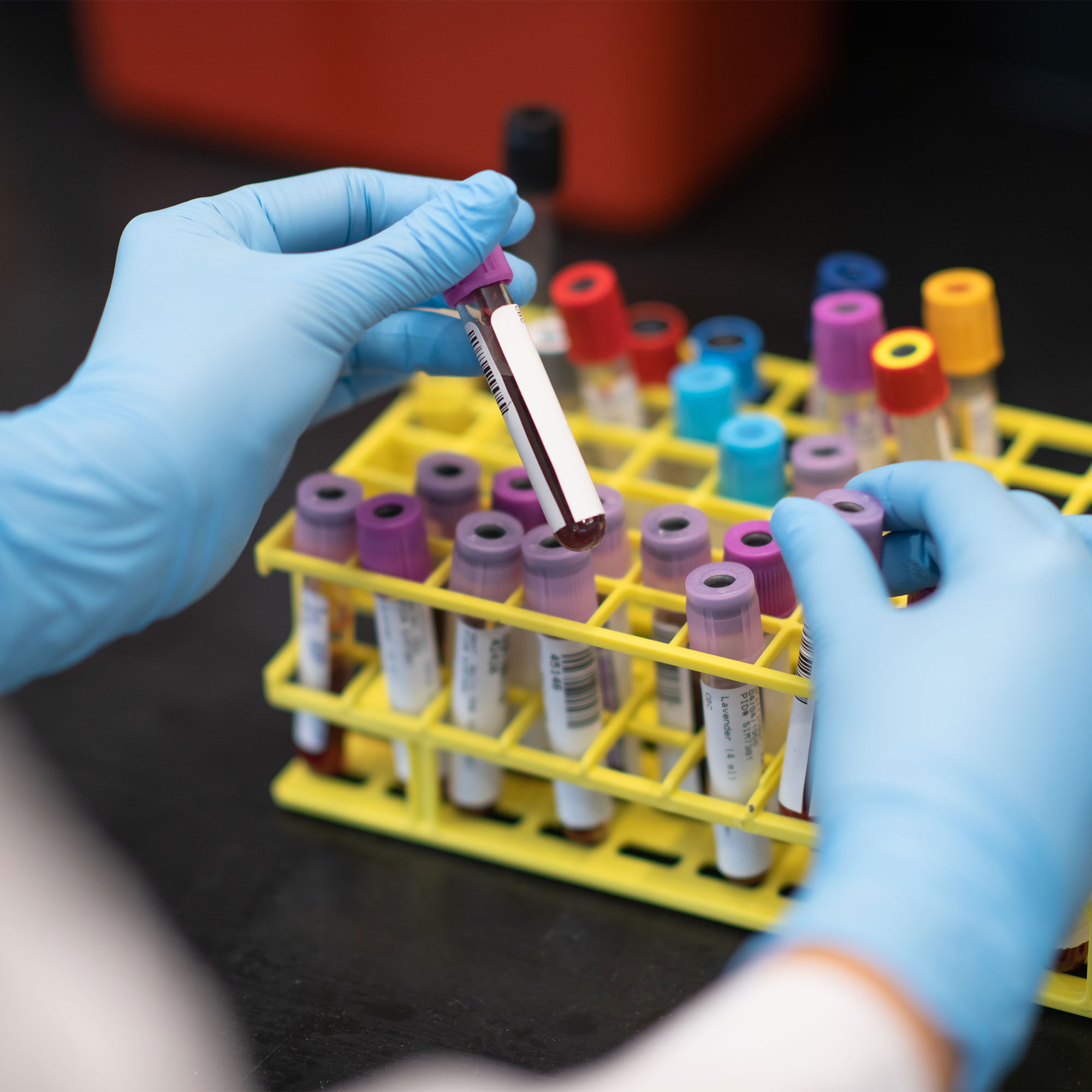实验室技术人员持有血液小瓶样品