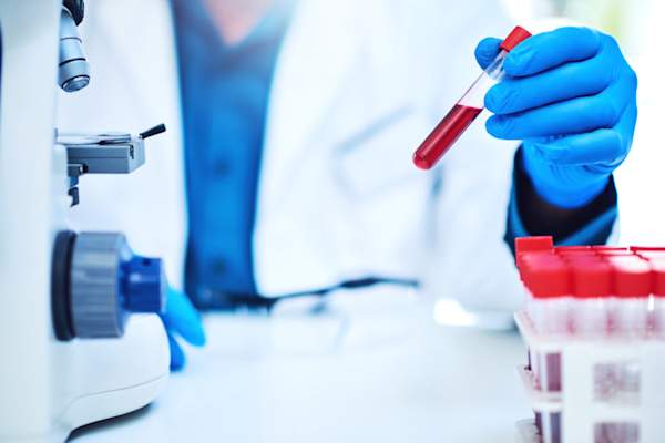 科学家戴着手套,手里拿着血样