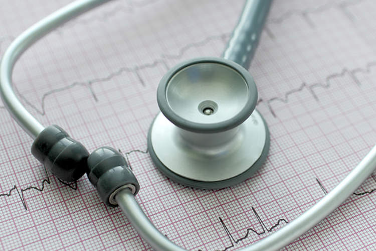 心电图上的听诊器。