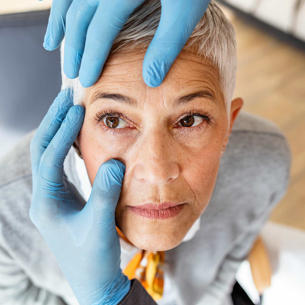 医生认为一个女人的眼睑开放