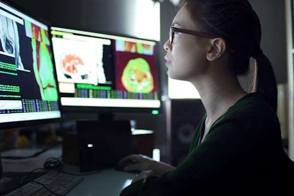 医生看着屏幕上的扫描