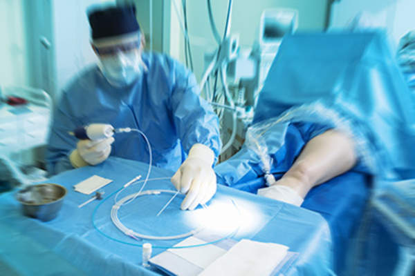 通过腿部静脉进行手术。