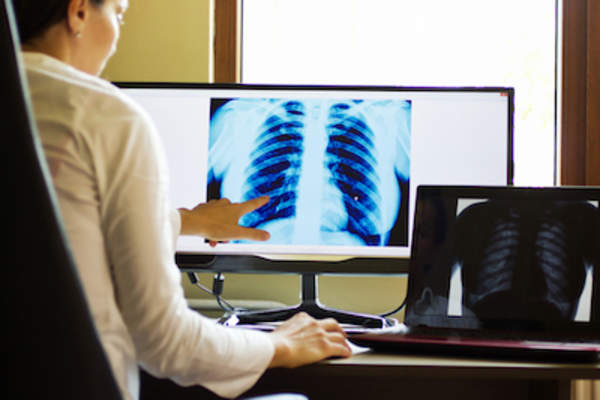 医生检查胸部X光检查。