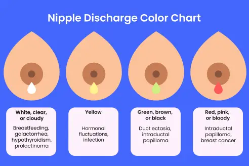 Breast changes are a normal part of pregnancy and occur as a result of  hormonal fluctuations. Changes to the breasts can occur as early a