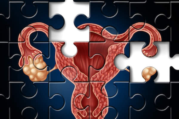 生育观念的挑战,难题。