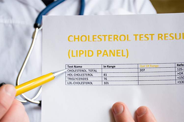 医生的胆固醇检查单。