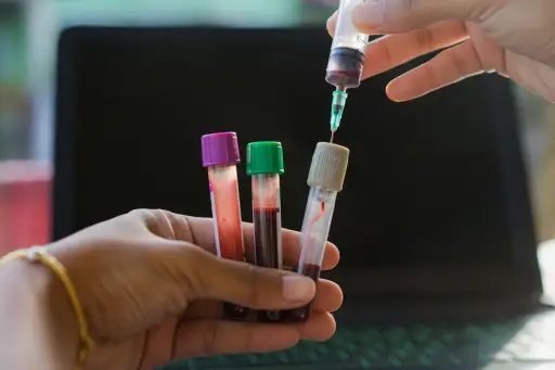 从患者进入真空管的输血，用于收集实验室中的血液样品。