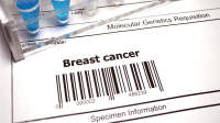 乳腺癌的基因测试。