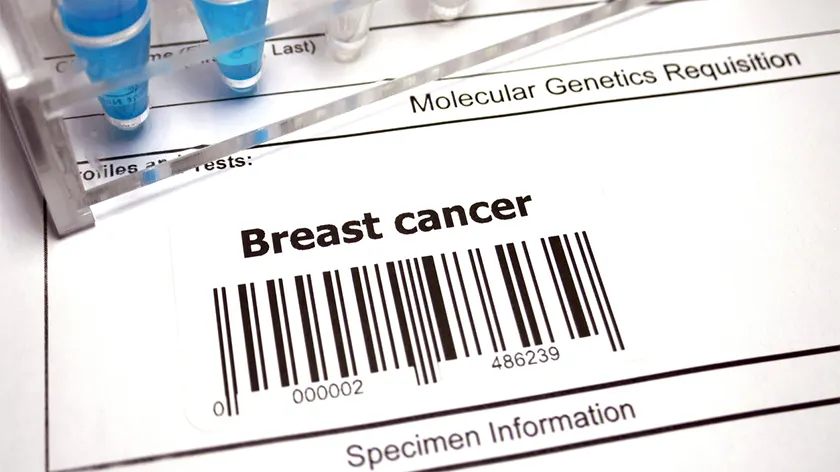 乳腺癌基因检测。
