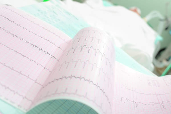 心电图与心律失常病人的。