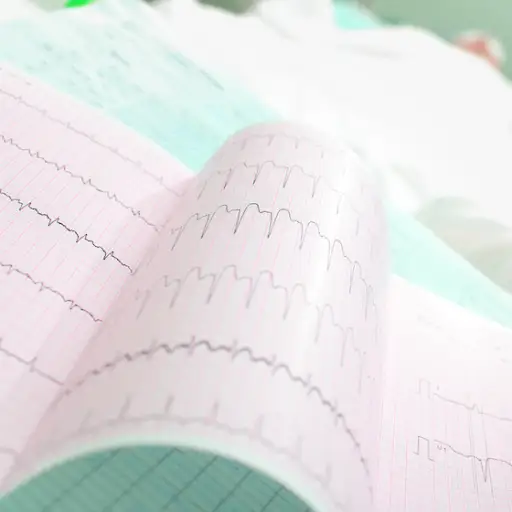 心律失常病人的心电图。