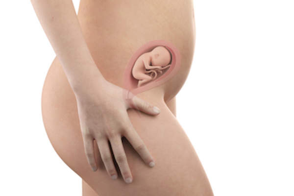 第五个月子宫切除,妊娠。