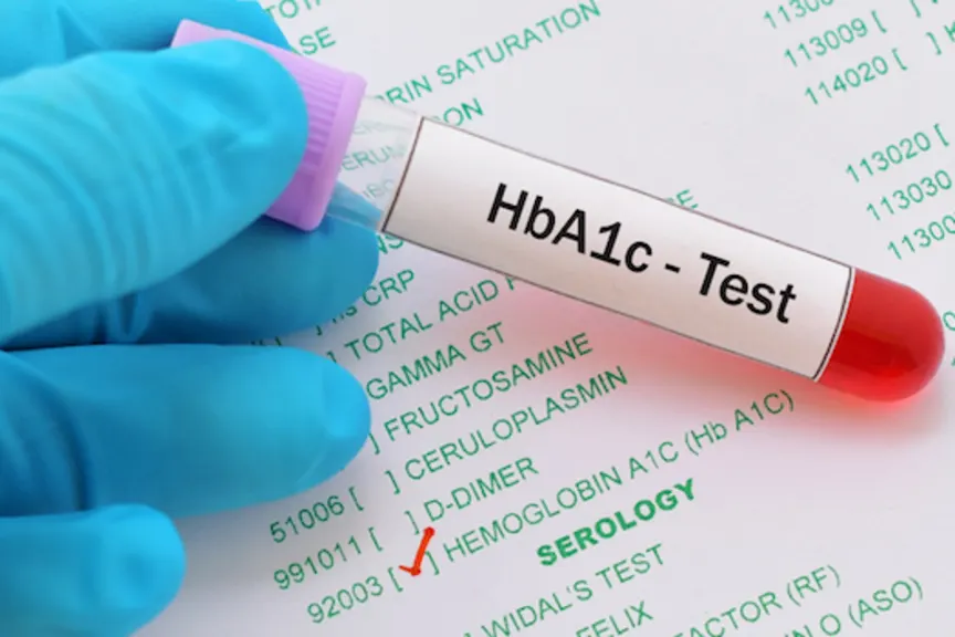 HBA1C血液测试在实验室中完成。