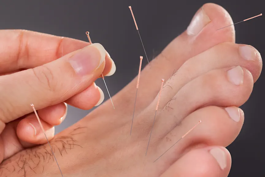 针灸的脚