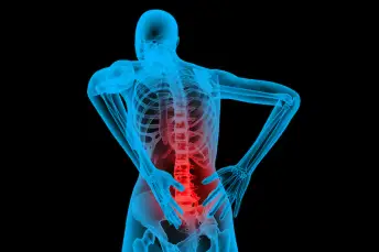 脊柱酸痛者之骨骼结构。