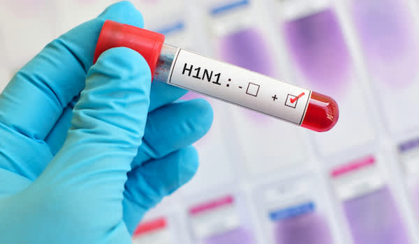 H1N1验血，病毒检测呈阳性。